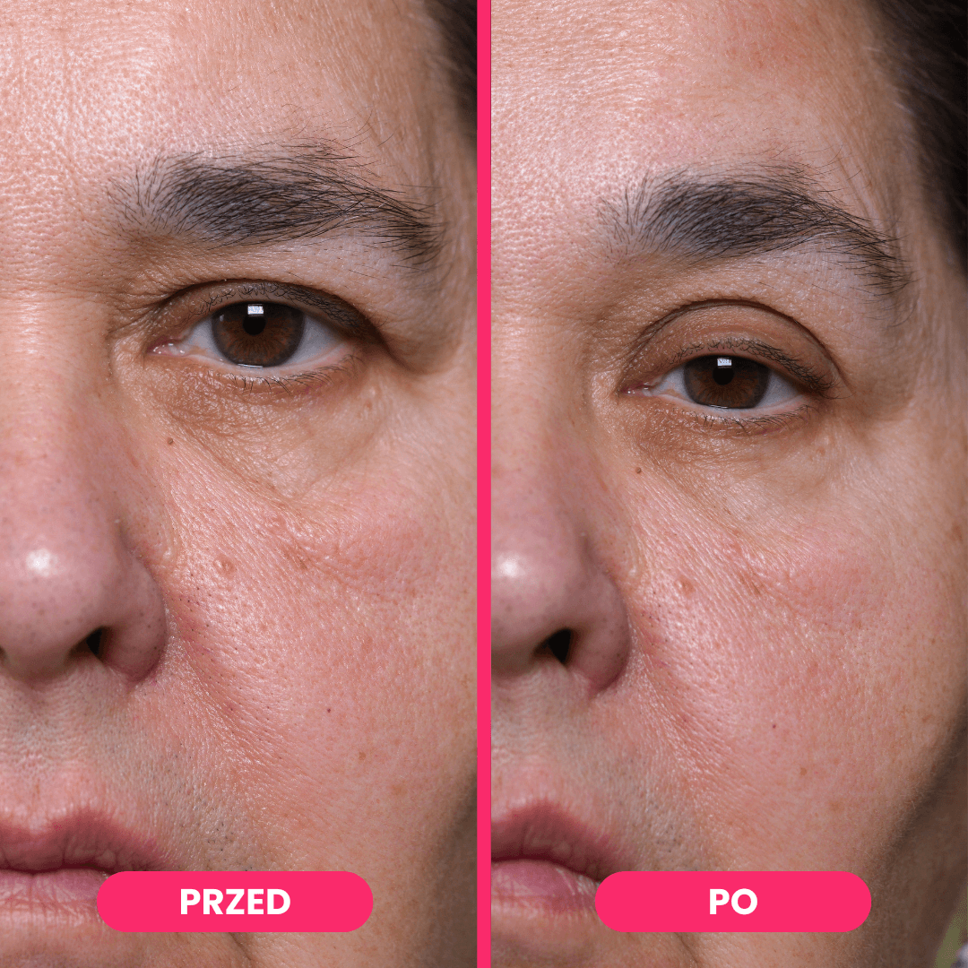 Eyefall - unieś powieki w 60 sekund bez drogich operacji (240 sztuk)